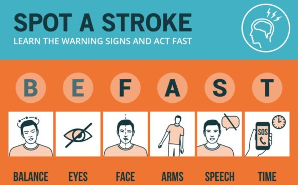 stroke infographic 2