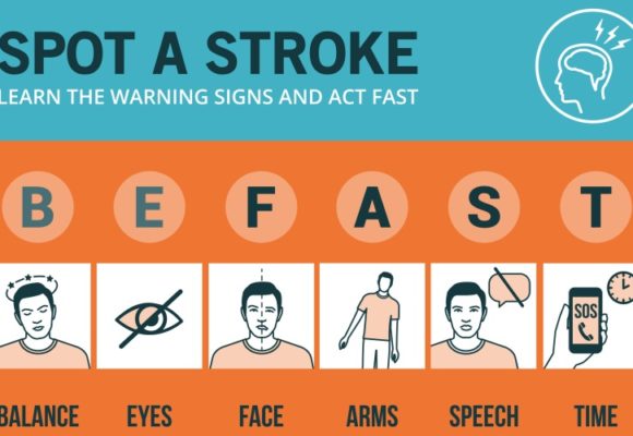 stroke infographic 2