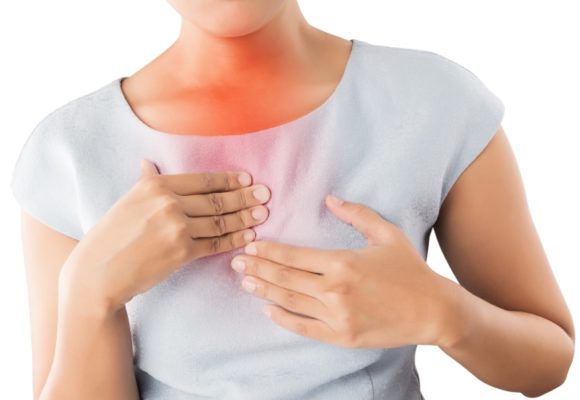 Young woman showing symptomatic acid reflux