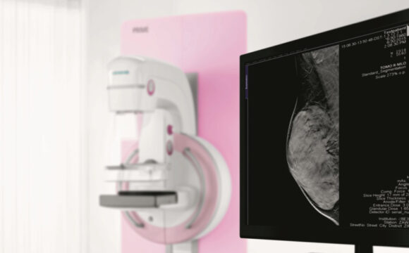 3D mammography breast imaging scan displayed on screen at Glacial Ridge Hospital