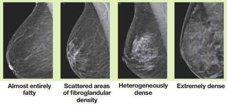 breast density scale