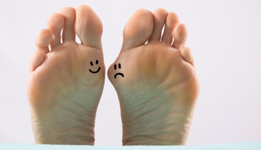 Bunions: More Than Meets the Eye