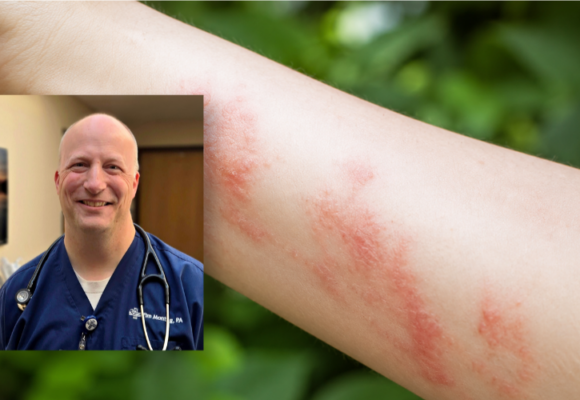 Medical Staff and Poison Ivy Rash